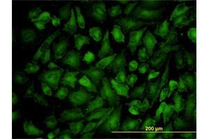 Immunofluorescence of monoclonal antibody to VCL on HeLa cell.