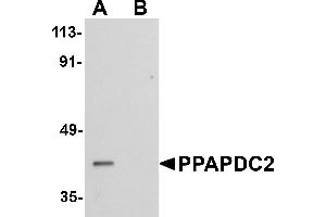 Western blot analysis of PPAPDC2 in Raji cell lysate with PPAPDC2 antibody at 1 µg/mL in (A) the absence and (B) the presence of blocking peptide. (PPAPDC2 anticorps  (C-Term))