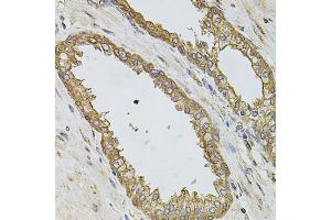Immunohistochemistry of paraffin-embedded human prostate using PIK3CA antibody (ABIN5970095) at dilution of 1/100 (40x lens). (PIK3CA anticorps)