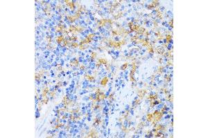 Immunohistochemistry of paraffin-embedded rat spleen using AARS antibody (ABIN7265526) at dilution of 1:100 (40x lens).
