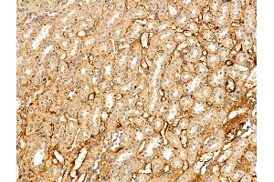 ABIN7094828 and ABIN7098879 at 1/100 staining Rat kidney tissue by IHC-P. (VLDLR anticorps  (N-Term))