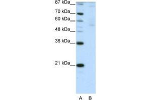 Western Blotting (WB) image for anti-Zinc Finger Protein 92 (ZNF92) antibody (ABIN2461991) (ZNF92 anticorps)