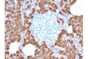 Formalin-fixed, paraffin-embedded human Pancreas stained with Carboxypeptidase A1 / CPA1 Mouse Monoclonal Antibody (CPA1/2714).