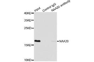 Immunoprecipitation analysis of 200ug extracts of MCF7 cells using 1ug NAA20 antibody. (NAT5 anticorps)