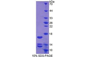 SDS-PAGE of Protein Standard from the Kit (Highly purified E.