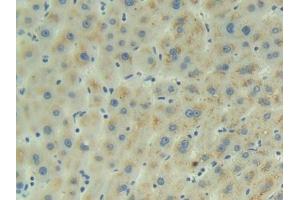 Detection of ADM in Human Liver Tissue using Polyclonal Antibody to Adrenomedullin (ADM)