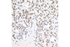 Immunohistochemistry (IHC) image for anti-Proline-, Glutamic Acid- and Leucine-Rich Protein 1 (PELP1) (AA 1000-1050) antibody (ABIN7453550) (PELP1 anticorps  (AA 1000-1050))