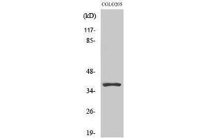Western Blotting (WB) image for anti-Olfactory Receptor, Family 5, Subfamily K, Member 1 (OR5K1) (Internal Region) antibody (ABIN6283105)