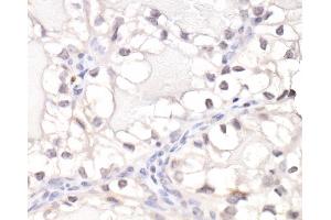 Immunohistochemistry (IHC) image for anti-Hypoxia Inducible Factor 1, alpha Subunit (Basic Helix-Loop-Helix Transcription Factor) (HIF1A) (C-Term) antibody (ABIN7455213)