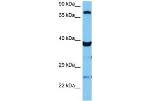 Host:  Mouse  Target Name:  TCF12  Sample Tissue:  Mouse Skeletal Muscle  Antibody Dilution:  1ug/ml (TCF12 anticorps  (N-Term))