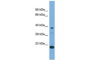 Host:  Rabbit  Target Name:  LIPT2  Sample Type:  293T Whole Cell lysates  Antibody Dilution:  1. (LIPT2 anticorps  (C-Term))