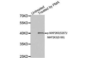 Western blot analysis of extracts of HL60 cell lines, using Phospho-MAP2K6-S207/MAP2K3-S189 antibody (ABIN5969926). (MAP2K6 anticorps  (pSer207))