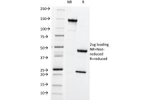SDS-PAGE Analysis Purified HLA-ABC Mouse Monoclonal Antibody (SPM419). (HLA-ABC anticorps)