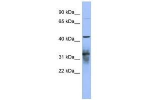 WB Suggested Anti-PABPC5 Antibody Titration:  0. (PABPC5 anticorps  (N-Term))