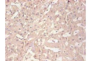 Immunohistochemical of paraffin-embedded human liver tissue using ABIN7152718 at dilution of 1:200