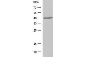 Western Blotting (WB) image for Proteasome (Prosome, Macropain) 26S Subunit, Non-ATPase, 4 (Psmd4) (AA 1-377) protein (His-IF2DI Tag) (ABIN7124629)