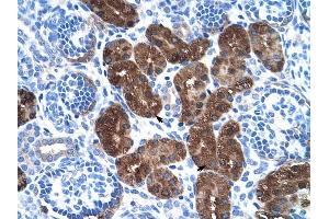 DDC antibody was used for immunohistochemistry at a concentration of 4-8 ug/ml to stain Epithelial cells of renal tubule (arrows) in Human Kidney.