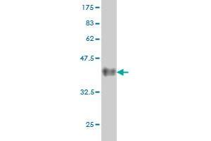 Western Blot detection against Immunogen (37.