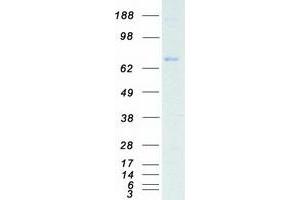 Validation with Western Blot