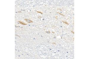 Immunohistochemistry of paraffin-embedded mouse spinal cord using  Rabbit mAb (ABIN7265424) at dilution of 1:1000 (40x lens).