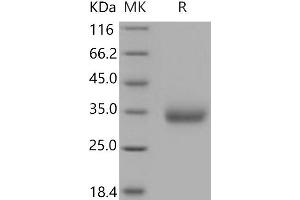 Western Blotting (WB) image for V-Set and Immunoglobulin Domain-Containing Protein 4 (VSIG4) protein (His tag) (ABIN7320379)