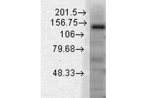 Western Blot analysis of Rat brain membrane lysate showing detection of Slo2.