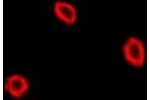Immunofluorescent analysis of NPC2 staining in U2OS cells. (NPC2 anticorps)