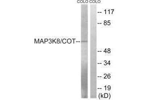Western blot analysis of extracts from COLO cells, treated with Insulin (0. (MAP3K8 anticorps  (Ser400))