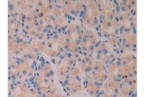 Detection of AZU in Human Stomach Tissue using Polyclonal Antibody to Azurocidin (AZU)