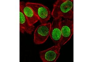 Fluorescent image of A549 cell stained with SUMO1 Antibody (N-term) (ABIN657634 and ABIN2846630). (SUMO1 anticorps  (N-Term))