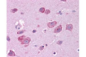 HGF antibody was used for immunohistochemistry at a concentration of 4-8 ug/ml. (HGF anticorps)