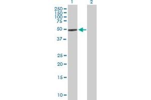 Western Blot analysis of COCH expression in transfected 293T cell line by COCH MaxPab polyclonal antibody.