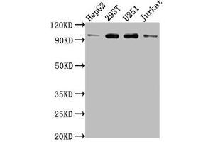 Western Blot Positive WB detected in: HepG2 whole cell lysate, 293T whole cell lysate, U251 whole cell lysate, Jurkat whole cell lysate All lanes: KPNB1 antibody at 1:2000 Secondary Goat polyclonal to rabbit IgG at 1/50000 dilution Predicted band size: 98, 82 kDa Observed band size: 98 kDa (KPNB1 anticorps  (AA 9-214))
