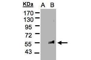 WB Image Western Blot analysis of FLVCR1 expression in transfected 293T cell line by FLVCR1 polyclonal antibody. (FLVCR anticorps  (C-Term))