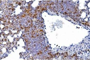 IHC analysis of CD226 using anti-CD226 antibody (ABIN7601264).