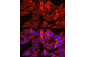 Immunofluorescence analysis of HepG2 cells using Proprotein Convertase 9(PCSK9) Rabbit pAb (ABIN6133851, ABIN6145328, ABIN6145330 and ABIN6223837) at dilution of 1:250 (40x lens).