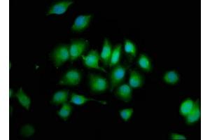 Immunofluorescence staining of A549 cells with ABIN7174107 at 1:200, counter-stained with DAPI. (PTPN3 anticorps  (AA 365-505))