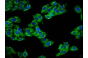 Immunofluorescence staining of HepG2 cells with ABIN7154588 at 1:133, counter-stained with DAPI. (REM1 anticorps  (AA 2-153))