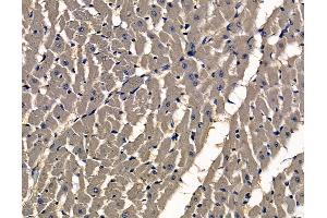 ABIN7097001 and ABIN7101068 at 1/100 staining rat heart tissue by IHC-P.