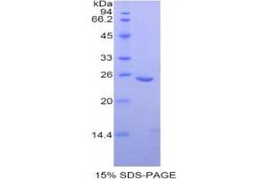 SDS-PAGE analysis of Human OSF Protein.