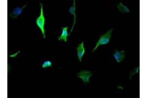 Immunofluorescence staining of U251 cells with ABIN7142109 at 1:50, counter-stained with DAPI.