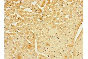 Immunohistochemistry of paraffin-embedded human heart tissue using ABIN7152437 at dilution of 1:100 (FBXO4 anticorps  (AA 138-387))