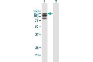 Western Blot analysis of PDGFRA expression in transfected 293T cell line by PDGFRA MaxPab polyclonal antibody. (PDGFRA anticorps  (AA 1-1089))