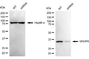Western blotting analysis using GRHPR antibody (ABIN7798787). (GRHPR anticorps)
