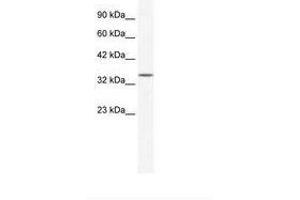 Image no. 1 for anti-Zinc Finger Protein 589 (ZNF589) (AA 185-234) antibody (ABIN203078) (ZNF589 anticorps  (AA 185-234))