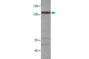 Western blot analysis of A-549 cell lysate with ADCY9 polyclonal antibody  at 1:500 dilution. (ADCY9 anticorps)