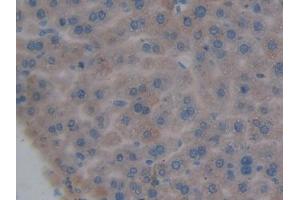 DAB staining on IHC-P; Samples: Mouse Liver Tissue