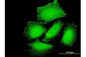 Immunofluorescence of purified MaxPab antibody to PPP1R3B on HeLa cell.