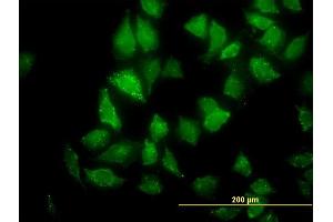 Immunofluorescence of monoclonal antibody to CNO on HeLa cell. (BLOC1S4 anticorps  (AA 108-217))