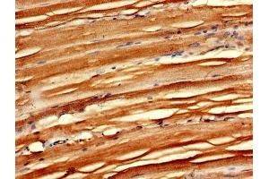 IHC image of ABIN7158870 diluted at 1:600 and staining in paraffin-embedded human skeletal muscle tissue performed on a Leica BondTM system.